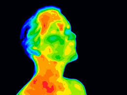 Thermography