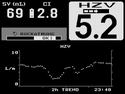 Non-invasive Cardiac Output-NICO